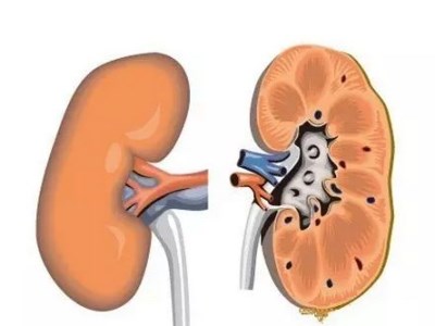 全自動生化分析儀淺析腎結(jié)石的原因，你中招了嗎—山東國康