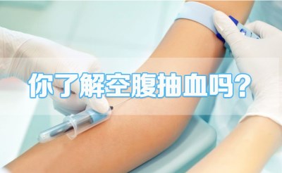 全自動生化儀品牌-生化檢測抽血的具體要求，山東國康