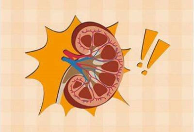 全自動生化儀品牌解析慢性腎臟病要注意的重點-山東國康
