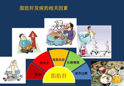 生化分析儀廠家淺談你是否有脂肪肝-山東國康