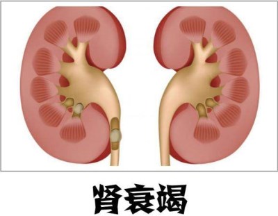 全自動生化分析儀是判斷腎衰竭的重要設備-山東國康