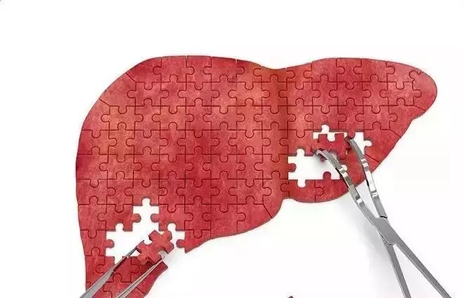 聽覺統(tǒng)合訓練儀提醒肝臟不好有這些表現(xiàn)