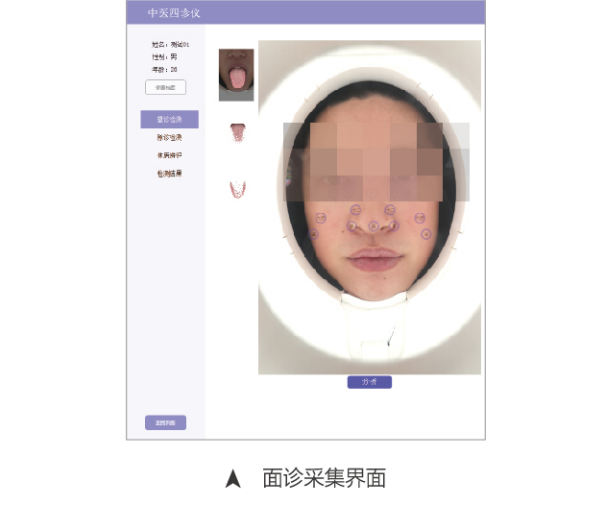 中醫(yī)四診儀02型（舌面脈信息采集管理系統(tǒng)）MT-SMT-02面診采集界面.png